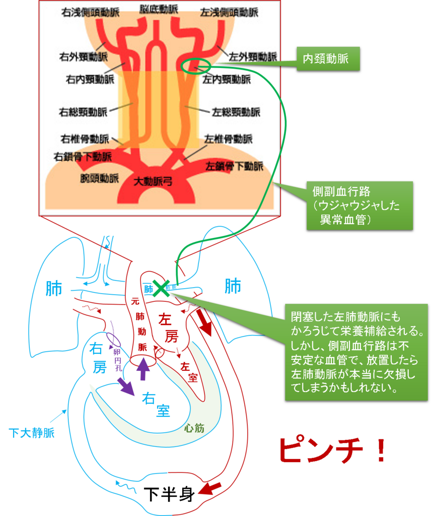 f:id:MoriKen254:20180525224638p:plain