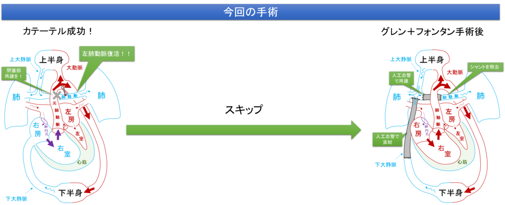 f:id:MoriKen254:20190228162152p:plain f:id:MoriKen254:20190228162152p:plain