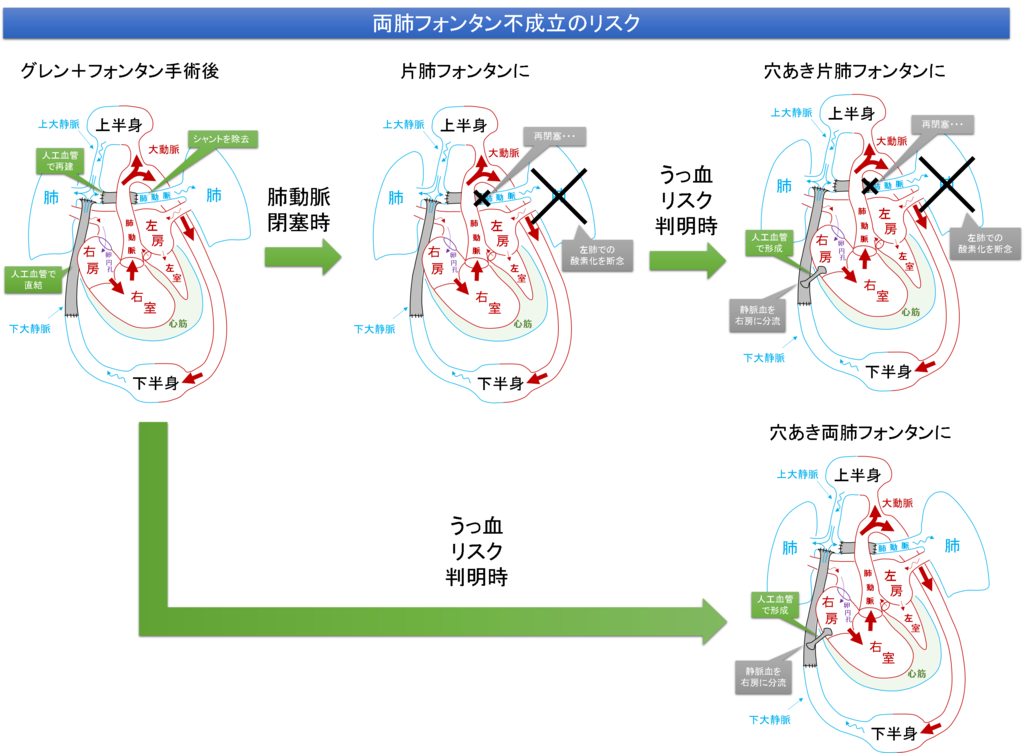 f:id:MoriKen254:20190228162536p:plain f:id:MoriKen254:20190228162536p:plain