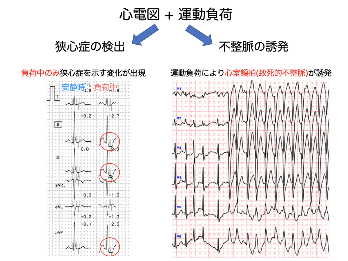 f:id:Mountain-Kuma:20200301154007p:plain f:id:Mountain-Kuma:20200301154007p:plain
