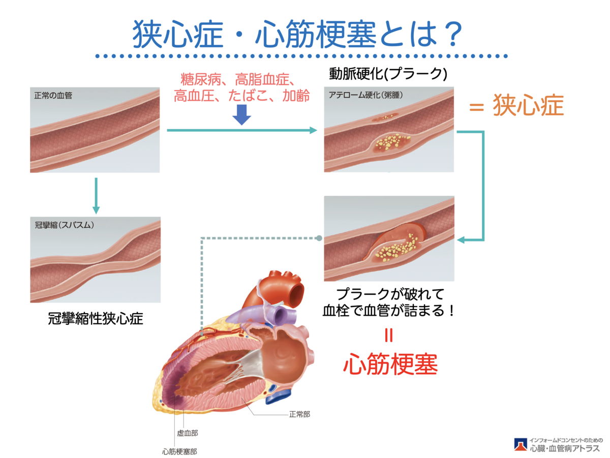 f:id:Mountain-Kuma:20200301163039p:plain f:id:Mountain-Kuma:20200301163039p:plain