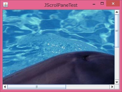 f:id:MrRadiology:20160803151917j:image:w360 f:id:MrRadiology:20160803151917j:image:w360