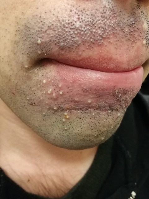 f:id:MrSoumen:20210313221154j:plain