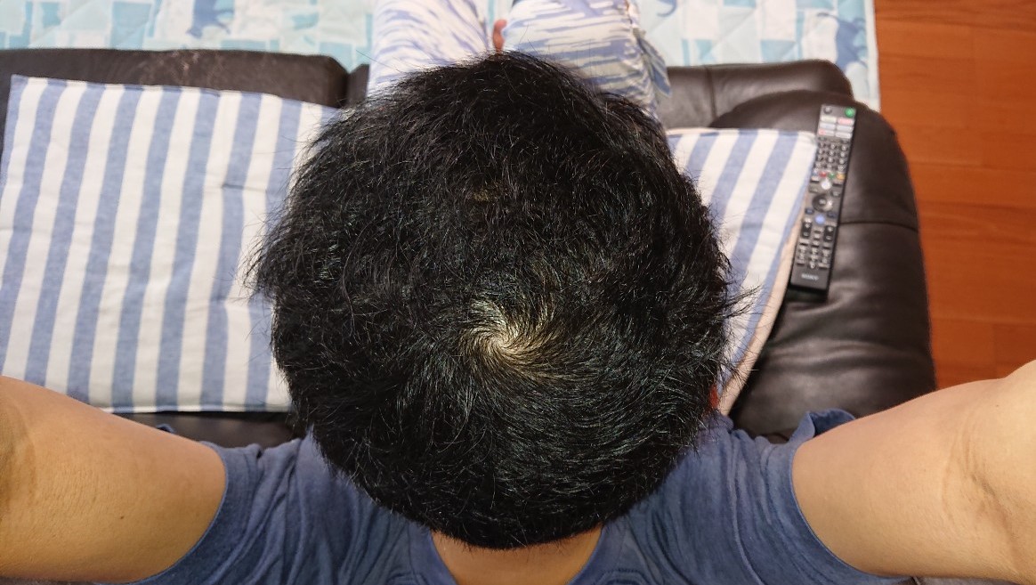 f:id:Mukumaru:20210901192008j:plain