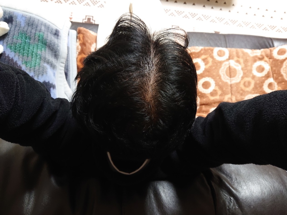 f:id:Mukumaru:20211201212053j:plain