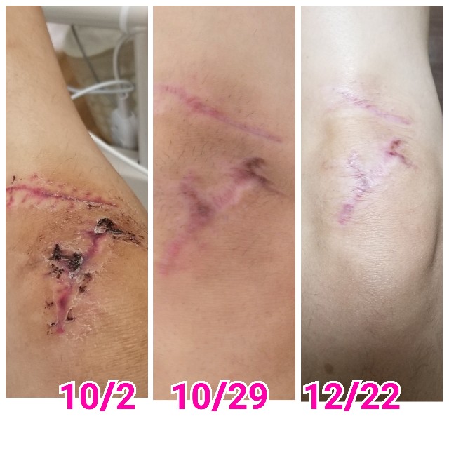 自転車は膝の痛みに効果があるの