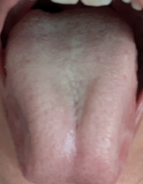 f:id:NARURU:20240930075306j:image f:id:NARURU:20240930075306j:image