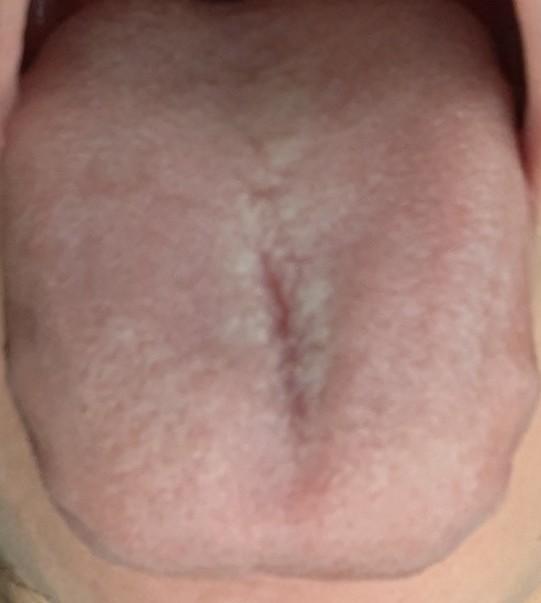 f:id:NARURU:20241005081747j:image f:id:NARURU:20241005081747j:image