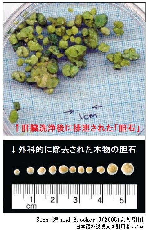 肝臓洗浄 レバーフラッシュ 肝臓デトックス は本当か Natromのブログ 肝臓洗浄 レバーフラッシュ 肝臓デトックス は本当か Natromのブログ