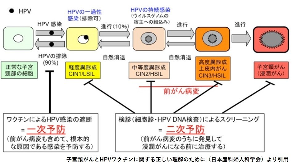 f:id:NATROM:20191028122048j:plain