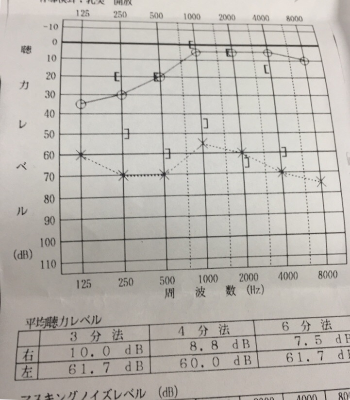 f:id:NEROLIOIL:20170218081009j:plain f:id:NEROLIOIL:20170218081009j:plain