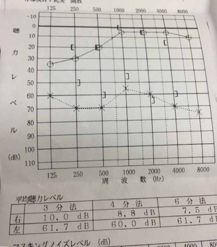 f:id:NEROLIOIL:20170218081009j:plain