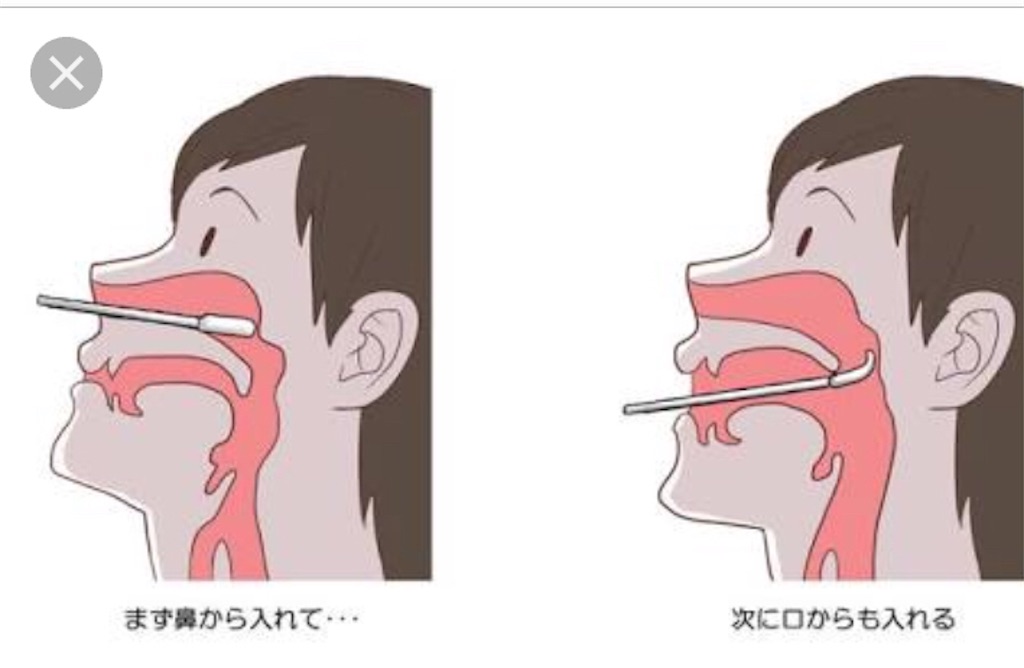 f:id:NOBUlog:20180802194137j:plain f:id:NOBUlog:20180802194137j:plain