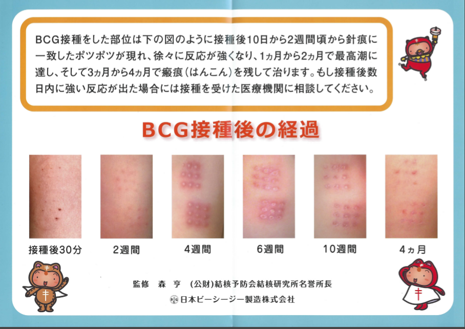 アビガン からの g からの イベルメクチン 専門的な事は何も書いてませんよ からの コロナ対策エンジニア 魁 itブログ アビガン からの g からの イベルメクチン 専門的な事は何も書いてませんよ からの コロナ対策エンジニア 魁 itブログ