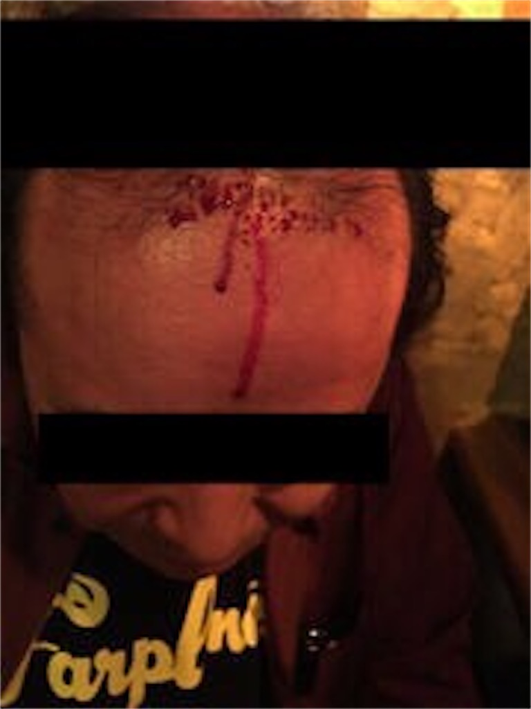 f:id:NaoNaooan:20220119123447j:image f:id:NaoNaooan:20220119123447j:image