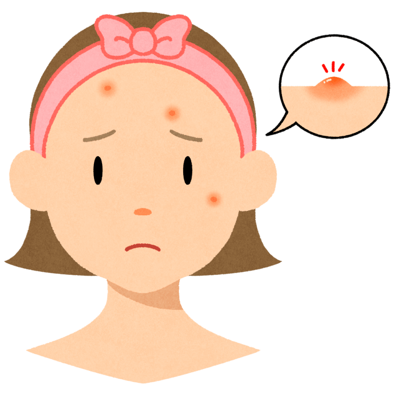 ニキビのフリーイラスト