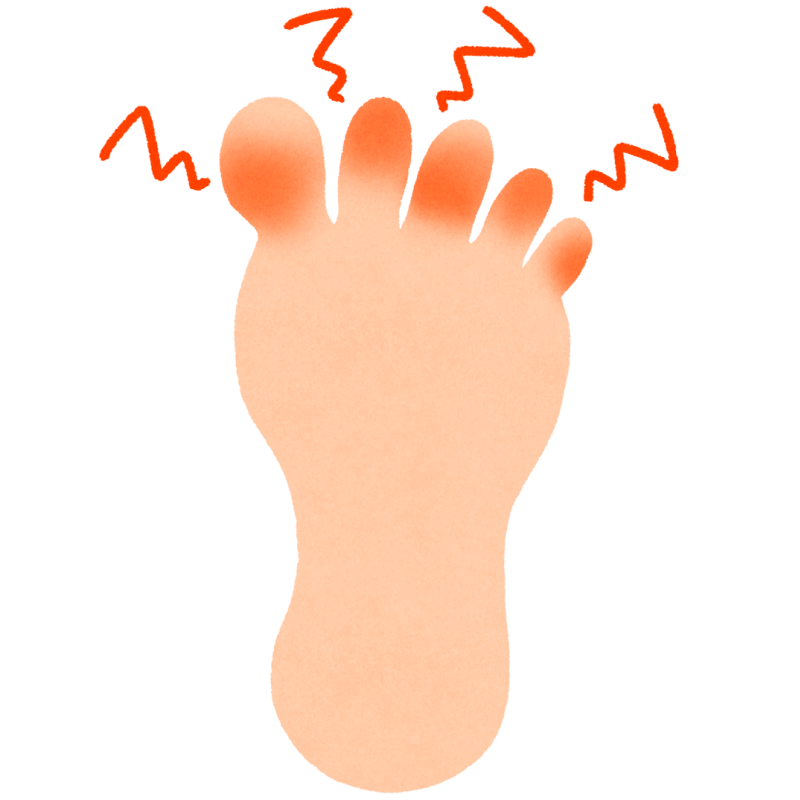 足のしもやけのフリーイラスト
