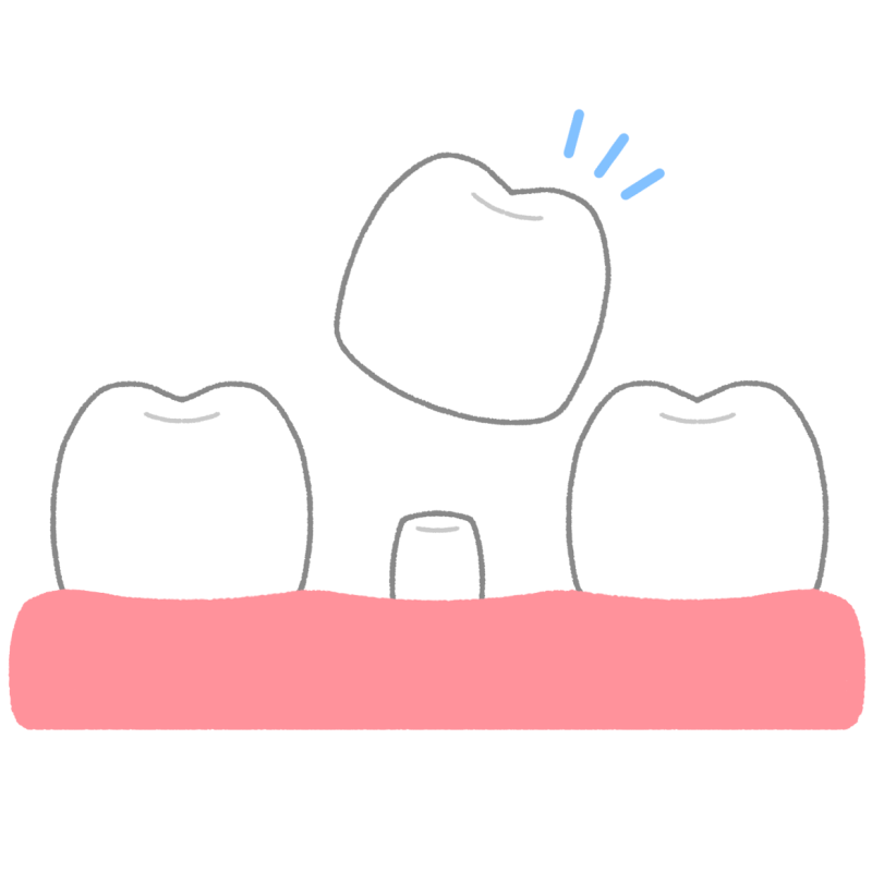 差し歯のフリーイラスト