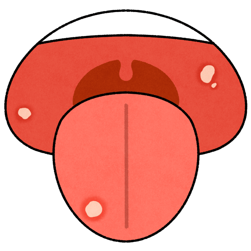口内炎のフリーイラスト