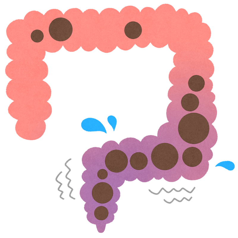 便秘のフリーイラスト