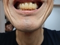 20240825171925