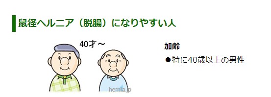 f:id:PARM:20160920220659j:plain f:id:PARM:20160920220659j:plain