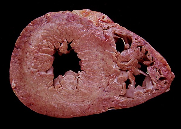 f:id:Parashraama:20191129161429j:plain