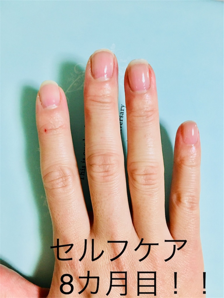 セルフケアで男爪から女爪への変化 ビフォーアフター写真 Pikoma家の子育てライフ