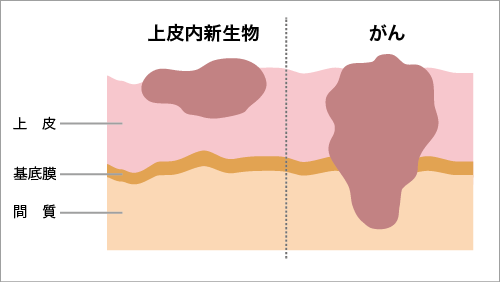 f:id:Poffice--Nishizono:20210309223347p:plain