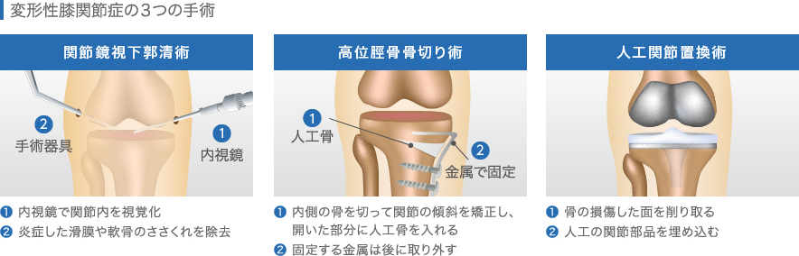 f:id:PojiShuri:20220109161445j:plain