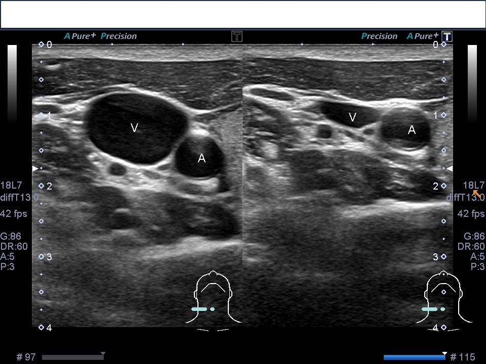 f:id:Rapyutatta:20200130091645j:plain