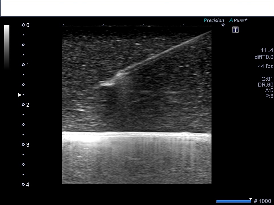 f:id:Rapyutatta:20200130094435j:plain