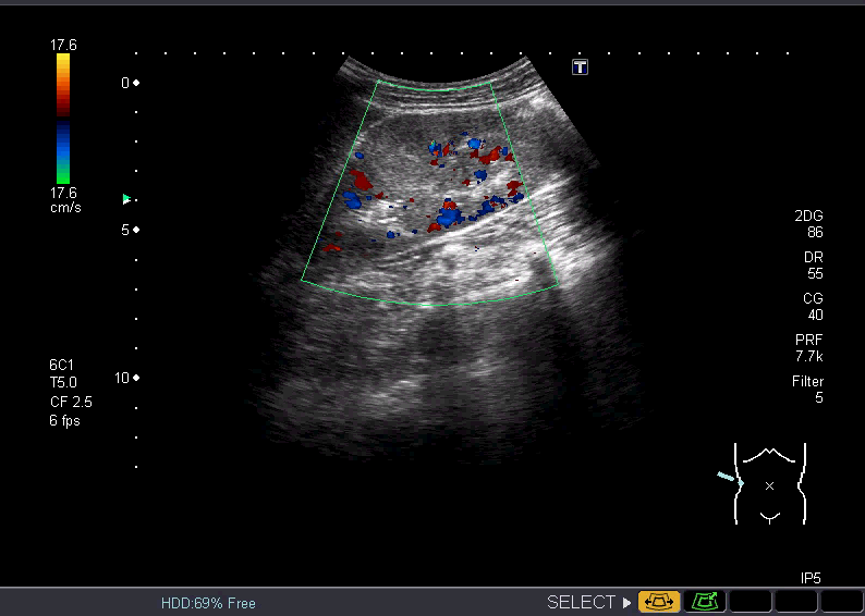 f:id:Rapyutatta:20200407170221p:plain f:id:Rapyutatta:20200407170221p:plain