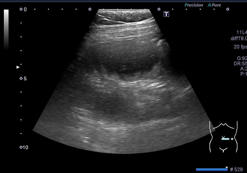 f:id:Rapyutatta:20210708142256j:plain