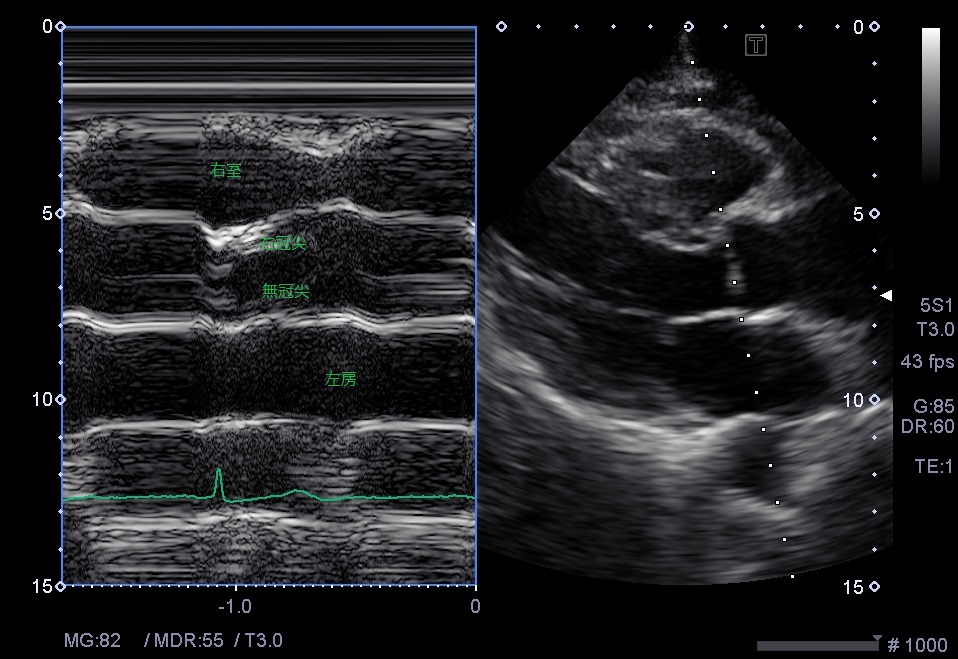 f:id:Rapyutatta:20210827115721j:plain