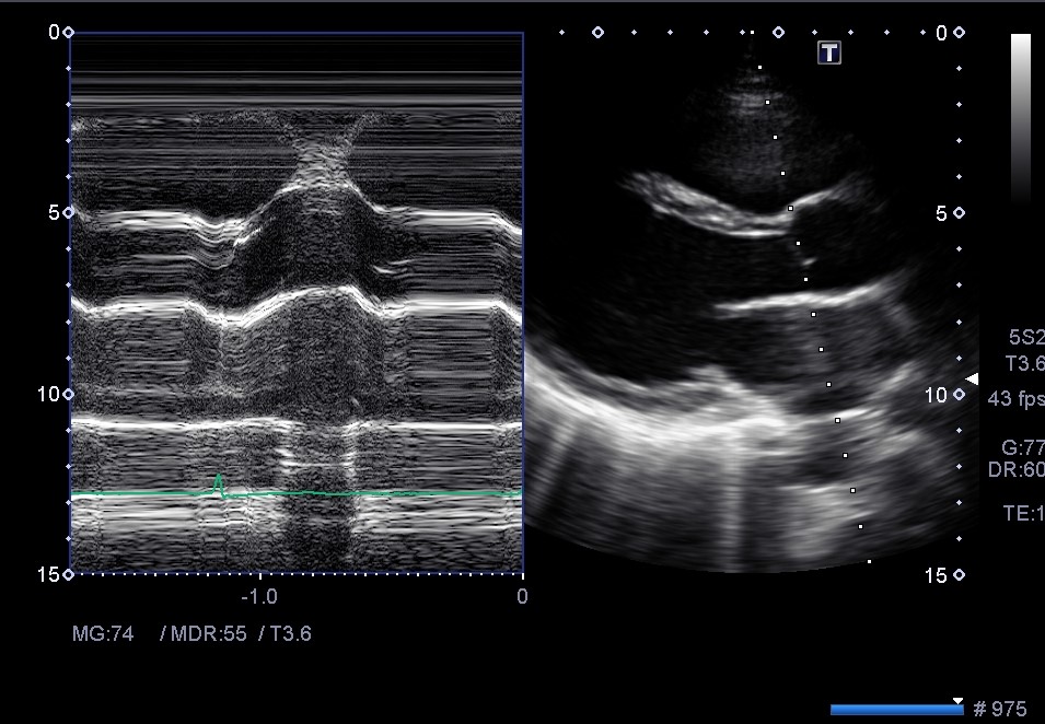 f:id:Rapyutatta:20210827160950j:plain