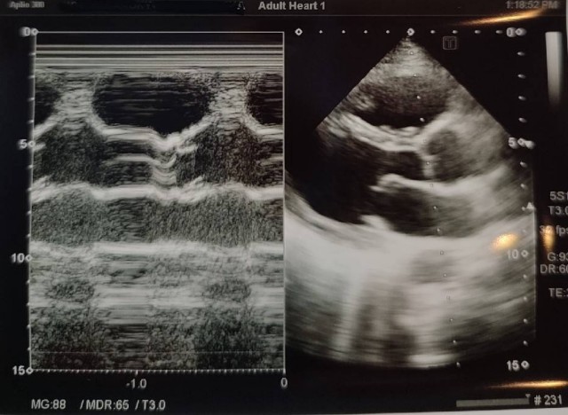 f:id:Rapyutatta:20210827164442j:image