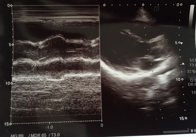 f:id:Rapyutatta:20210827171226j:image