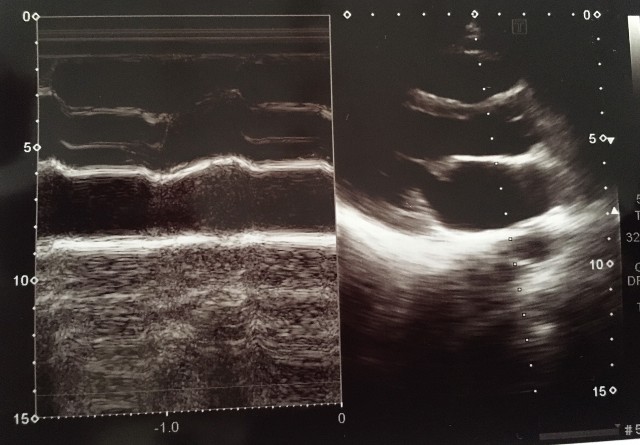 f:id:Rapyutatta:20210827171235j:image