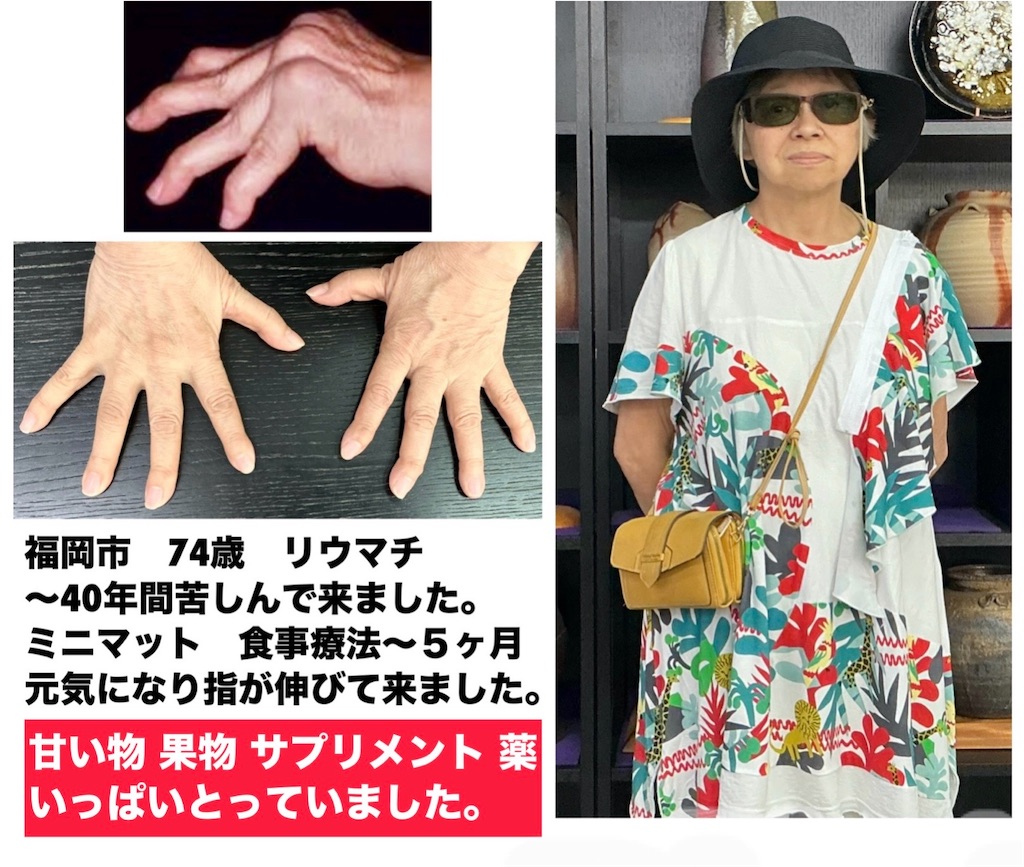 f:id:Rei-wa:20260323070239j:image f:id:Rei-wa:20260323070239j:image