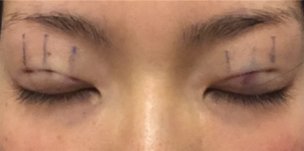 f:id:Ri9Gr:20220108190519j:plain