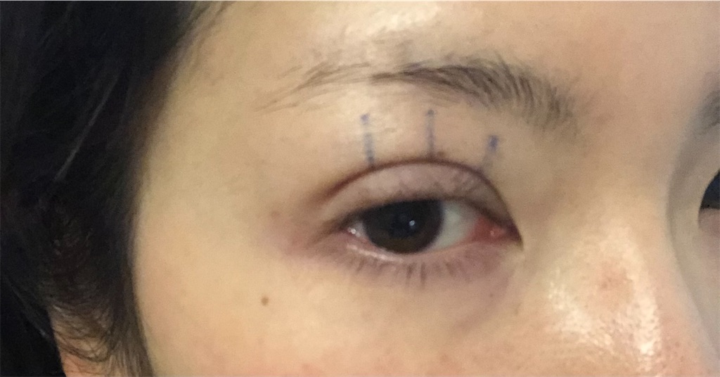 f:id:Ri9Gr:20220108192740j:plain