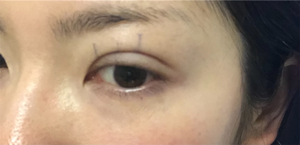 f:id:Ri9Gr:20220108192743j:plain