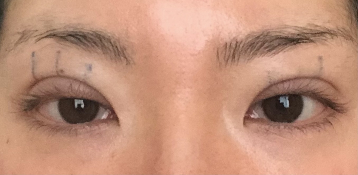 f:id:Ri9Gr:20220109152812j:plain