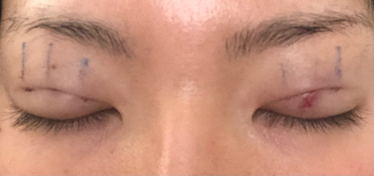 f:id:Ri9Gr:20220109152837j:plain