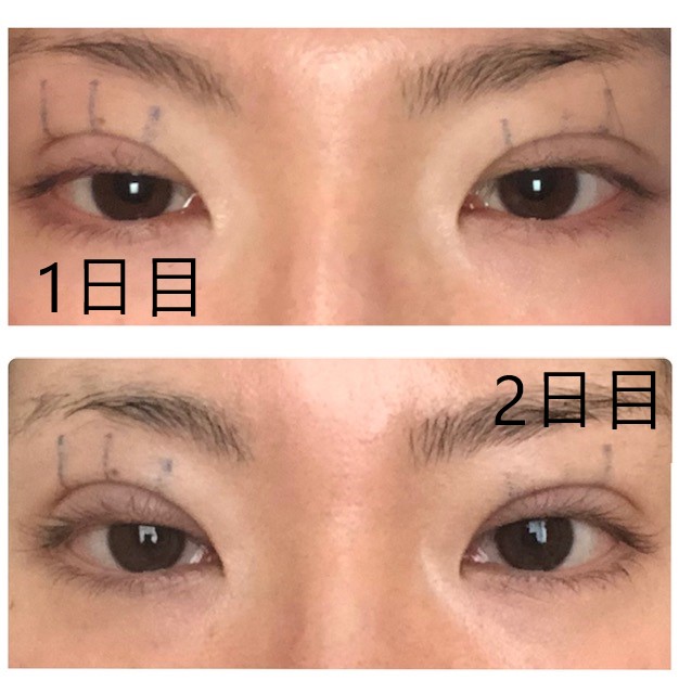 f:id:Ri9Gr:20220109152948j:plain