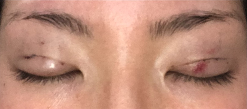 f:id:Ri9Gr:20220110153521j:plain