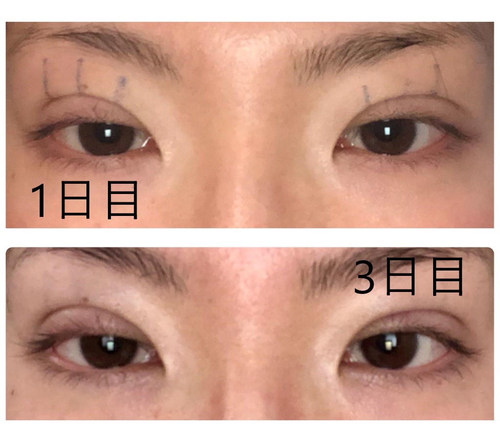 f:id:Ri9Gr:20220110154401j:plain