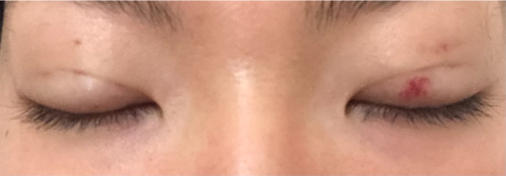 f:id:Ri9Gr:20220114153421j:image