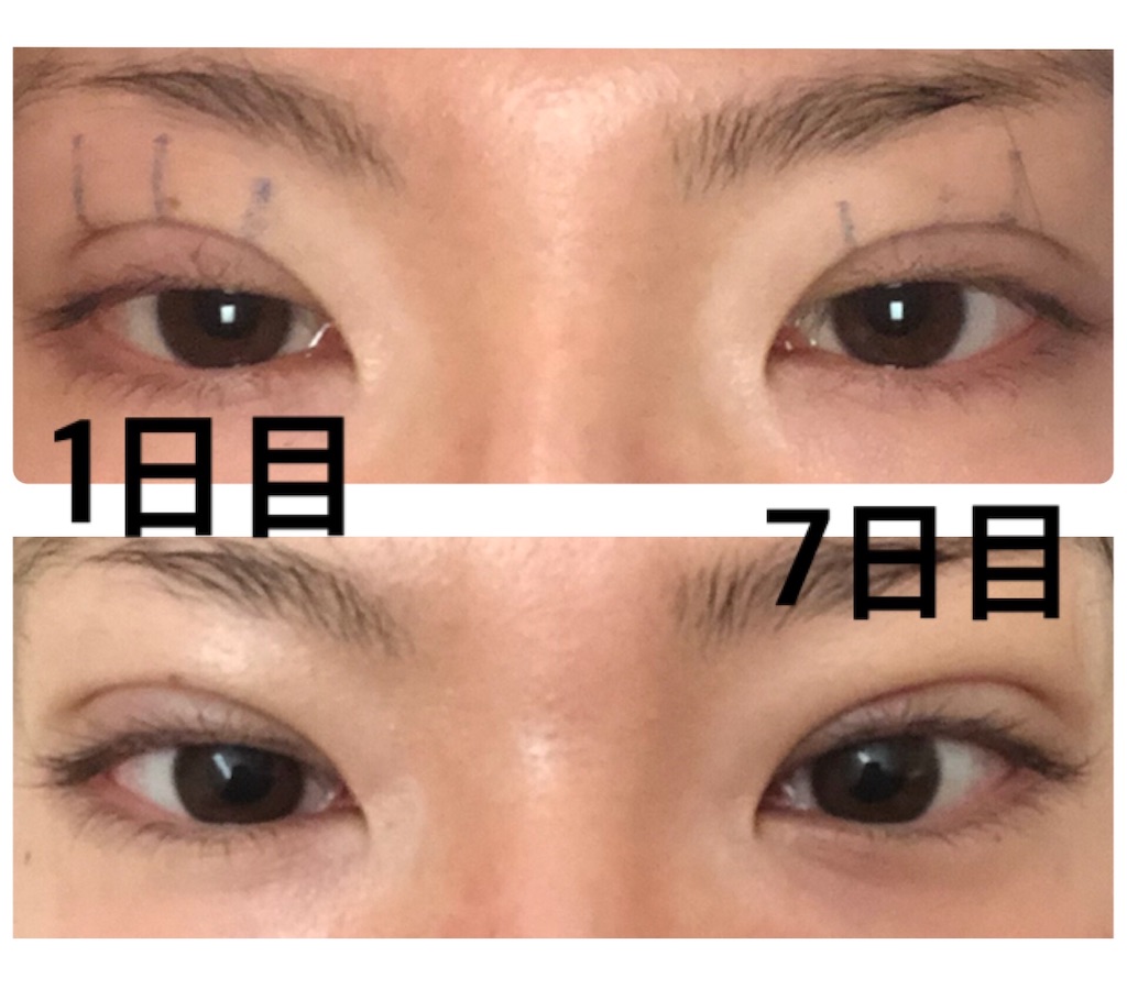 f:id:Ri9Gr:20220114153752j:image